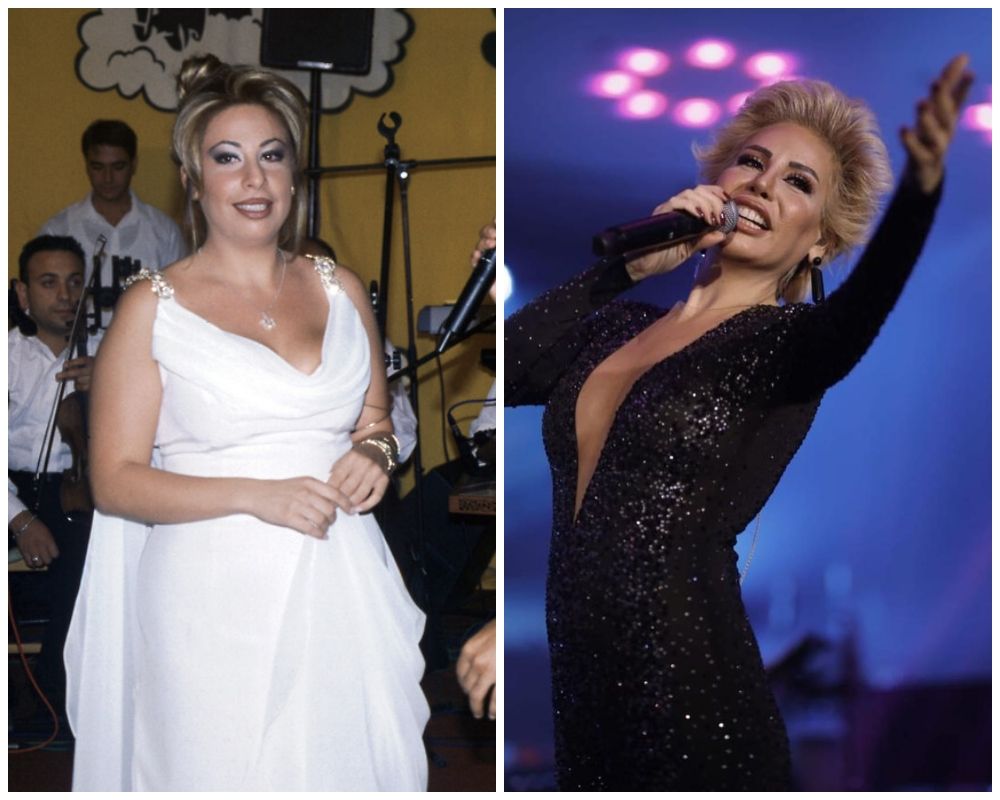 Eski haliyle şimdiki hali arasındaki fark inanılmaz! Şarkıcı Linet estetik operasyonlarına bir yenisini daha ekledi 10