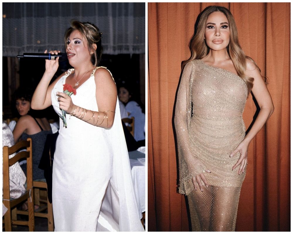 Eski haliyle şimdiki hali arasındaki fark inanılmaz! Şarkıcı Linet estetik operasyonlarına bir yenisini daha ekledi 8