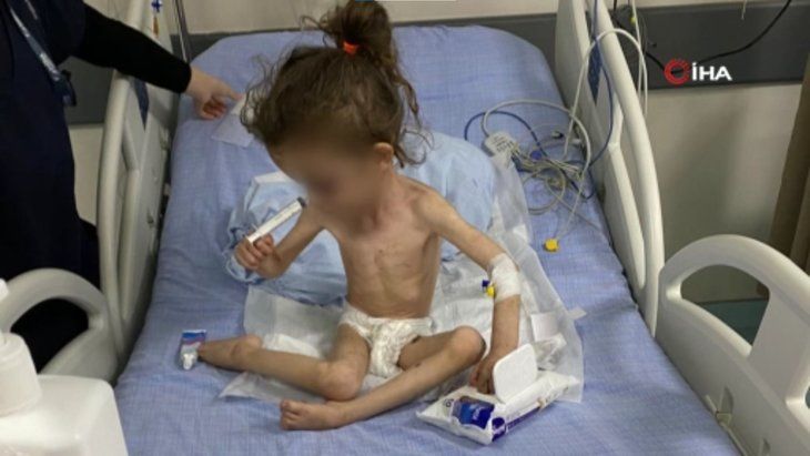 Gaziantep'te cani anne 5 yaşındaki çocuğuna günlerce işkence yaptı! Bakan Yanık'tan son dakika açıklaması... 5