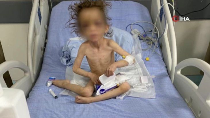 Gaziantep'te cani anne 5 yaşındaki çocuğuna günlerce işkence yaptı! Bakan Yanık'tan son dakika açıklaması... 1