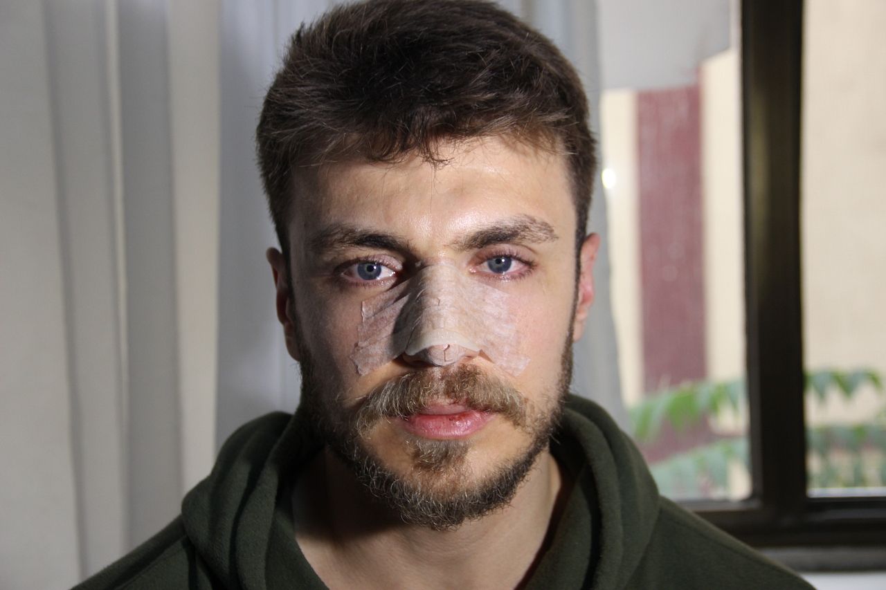 "Eşimin erkek doktora muayene olmasını istemiyorum" diyerek darp etmişti! İlk ifadesi ortaya çıktı: Bağırma sesleri geliyordu! 4