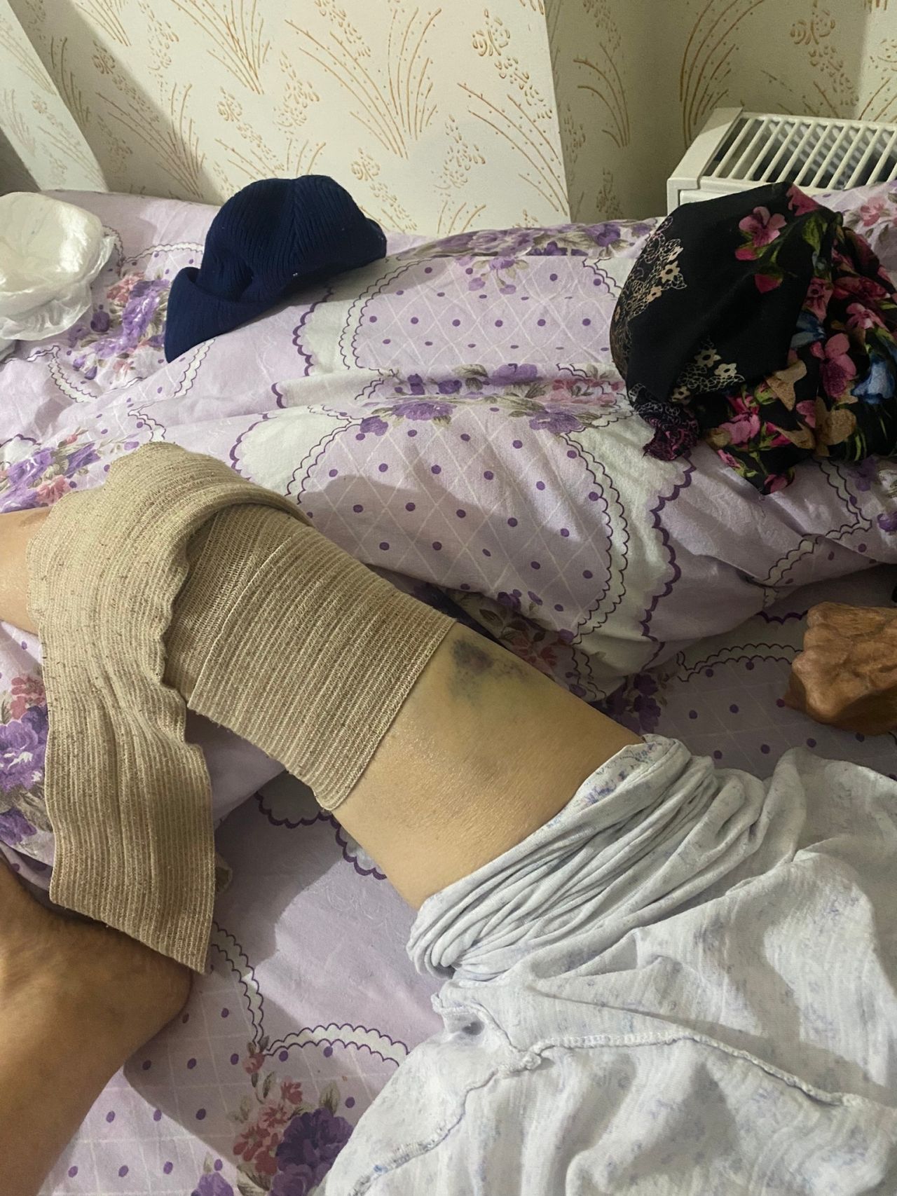 Ankara'da bakıcı dehşeti! Yaşlı kadının başından aşağı sıcak yemek döktü! 2