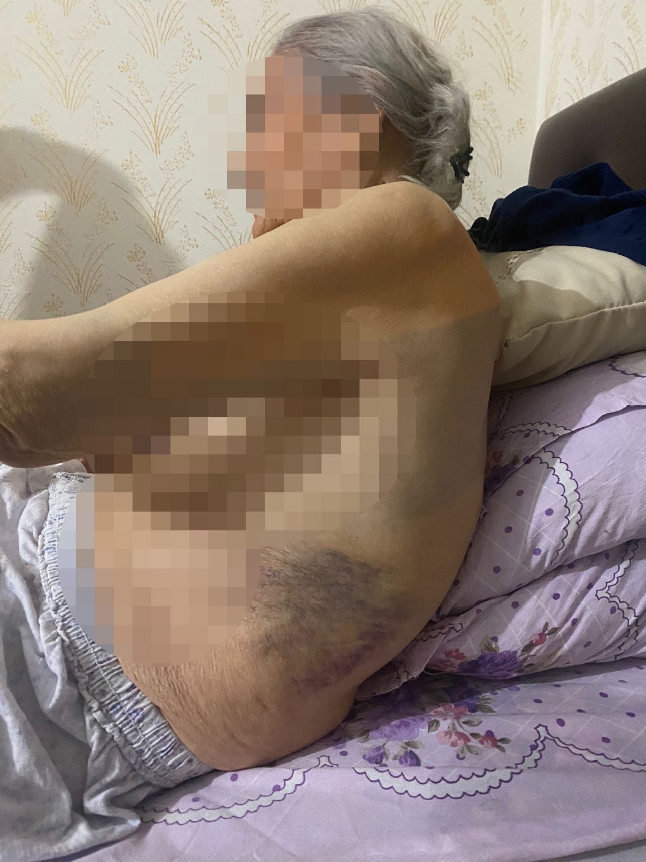 Ankara'da bakıcı dehşeti! Yaşlı kadının başından aşağı sıcak yemek döktü! 6