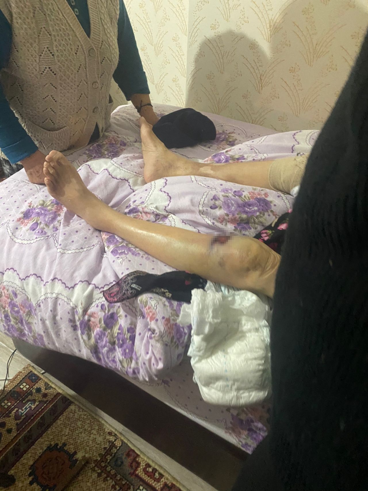Ankara'da bakıcı dehşeti! Yaşlı kadının başından aşağı sıcak yemek döktü! 3