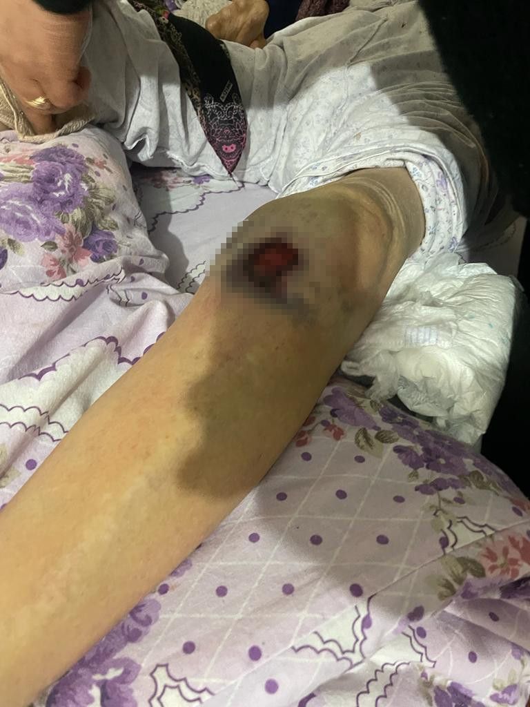 Ankara'da bakıcı dehşeti! Yaşlı kadının başından aşağı sıcak yemek döktü! 4
