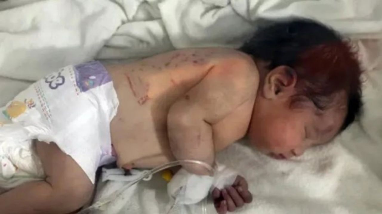 Ölen annesinin adı verildi! Suriye'de enkaz altında doğan Aya bebeğin yeni ailesi belli oldu 5