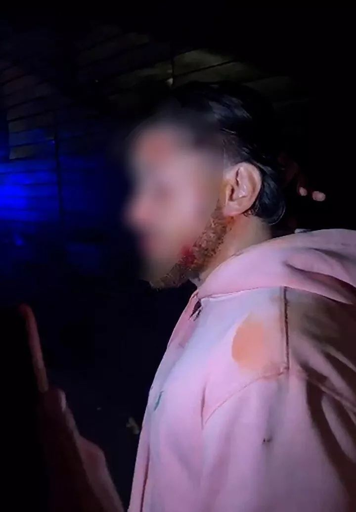 Brüksel'de skandal: PKK yanlıları oy kullanan gence saldırdı! 3