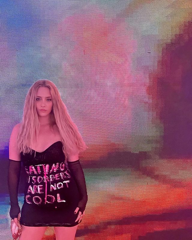 Hayal Köseoğlu'ndan itiraf! Mücadele ettiği hastalığı açıkladı 5
