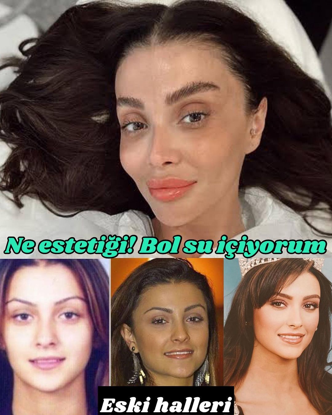 Estetik açıklaması sosyal medya kullanıcılarının diline düştü! Özge Ulusoy'u çileden çıkaran paylaşım: Jet hızında yanıt verdi, hızını alamayarak... 4