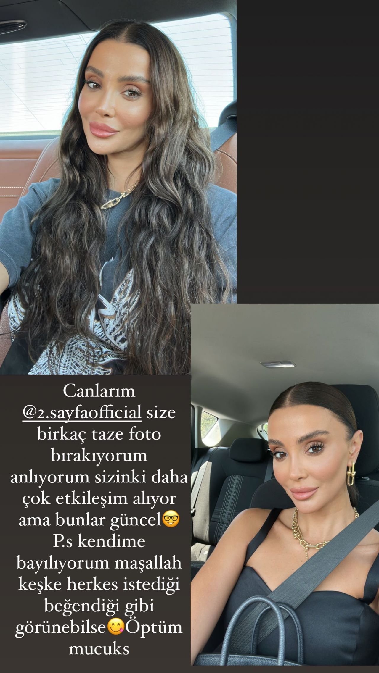 Estetik açıklaması sosyal medya kullanıcılarının diline düştü! Özge Ulusoy'u çileden çıkaran paylaşım: Jet hızında yanıt verdi, hızını alamayarak... 6