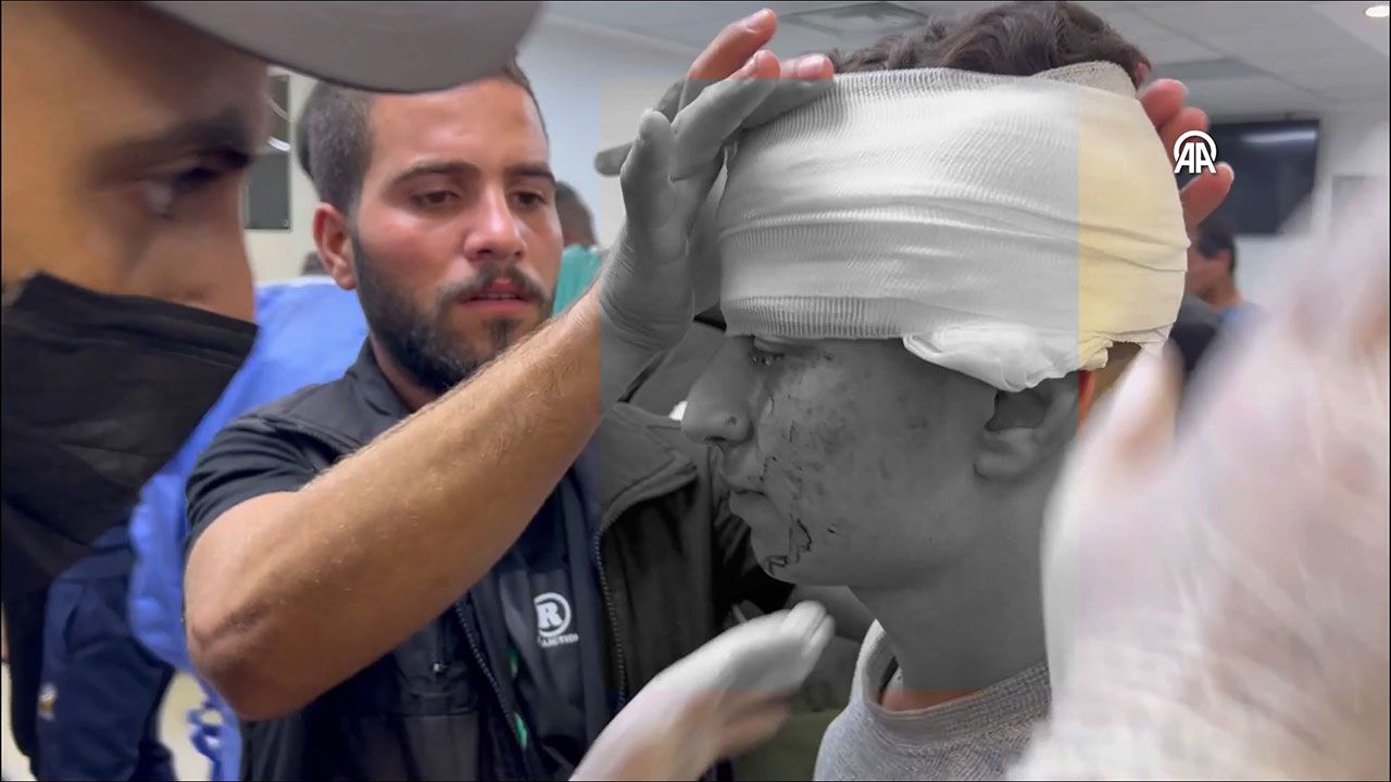 İsrail Gazze'de hastane vurdu! İşte o görüntüler... 24