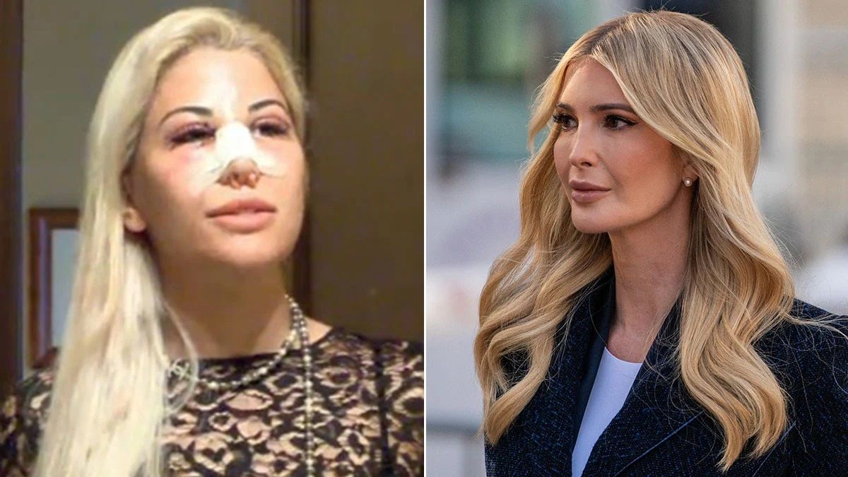 Donald Trump'ın kızı Ivanka Trump yüzündeki değişimle gündem oldu! Estetik operasyonlarıyla güzelliğine güzellik kattı 8