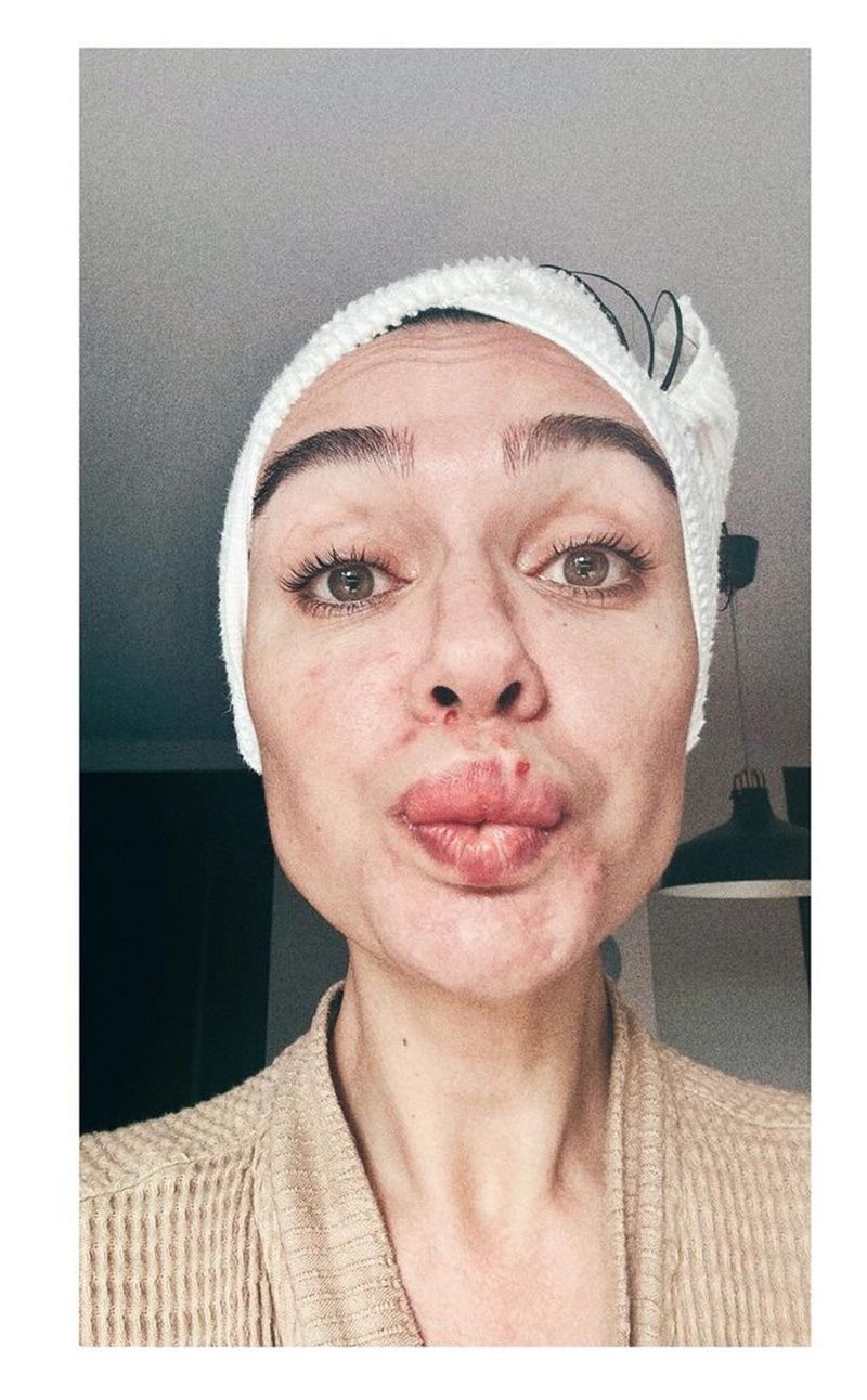 Birce Akalay, sıfır makyajlı hali ile kamera karşısına geçti! Son hali şaşkına çevirdi 4