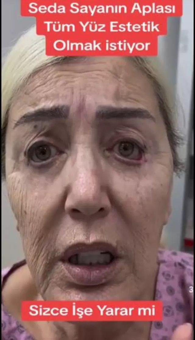 Onlarca operasyon geçiren Seda Sayan, ablası Nursel Yıldız'a da estetik yaptırdı! Son hali şoke etti 4