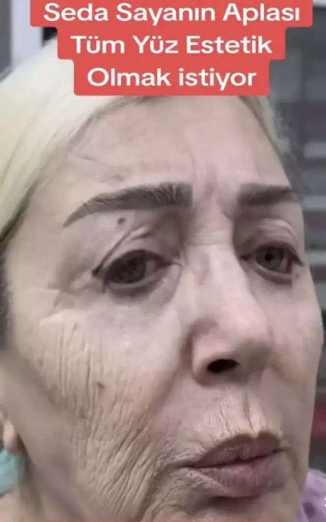 Onlarca operasyon geçiren Seda Sayan, ablası Nursel Yıldız'a da estetik yaptırdı! Son hali şoke etti 5