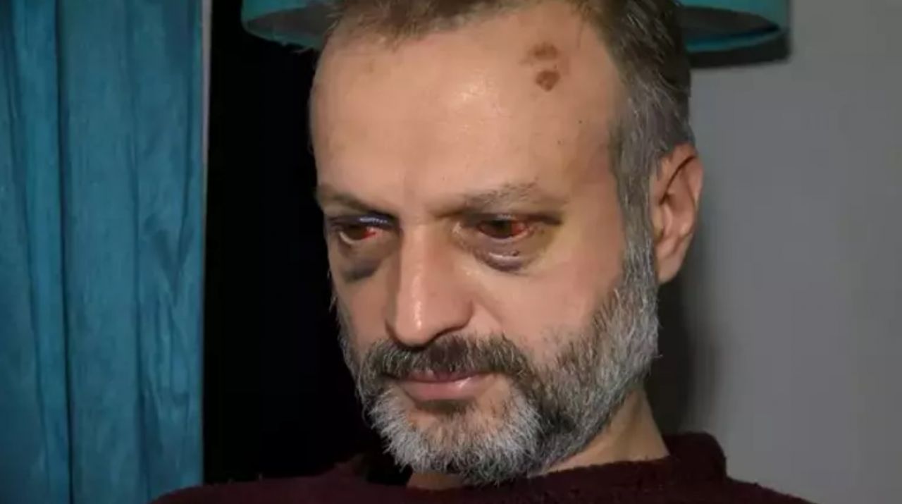 ‘Çiftetelli’ çalmadı diye öldüresiye dövdüler: "Hayvanca saldırdılar" 6