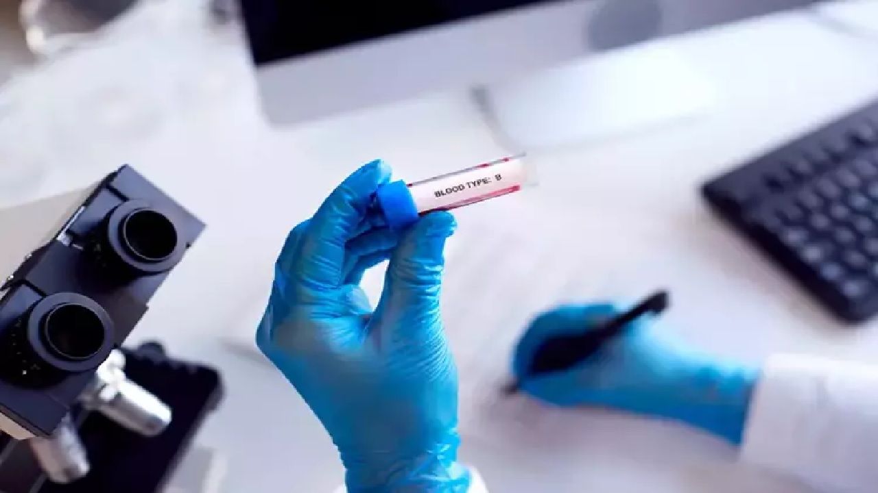 Japon bilimciler açıkladı! O kan grubuna sahip olanlar zeki oluyor... 1