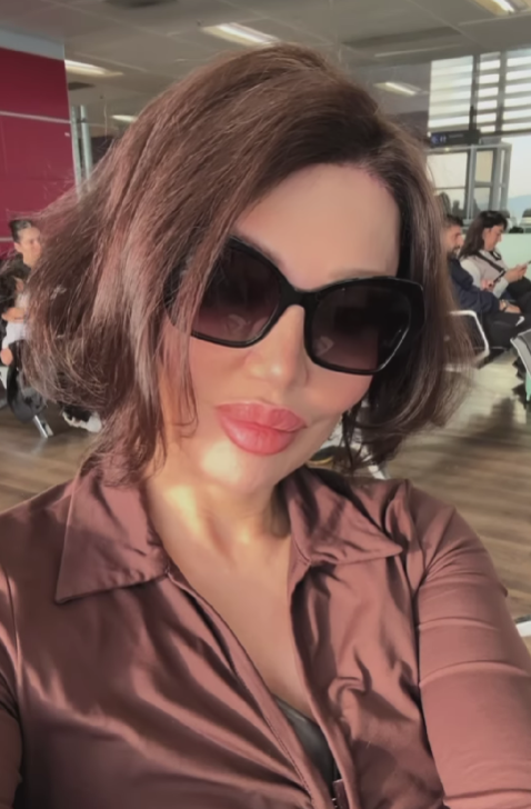 Alın daraltma ameliyatı olmuştu! İmaj değiştiren Umut Akyürek, Belgin Doruk'a benzetildi 6