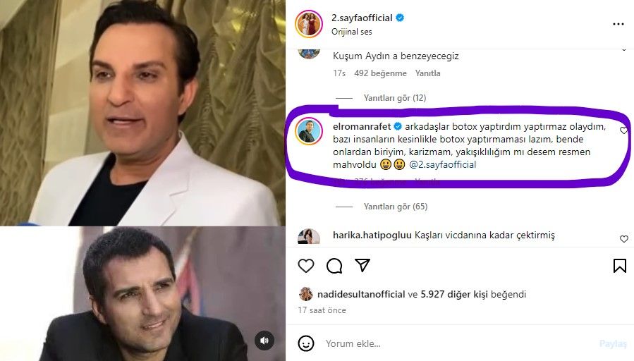 Yüzündeki değişim dikkat çekmişti! Rafet El Roman'ın botoks pişmanlığı 4