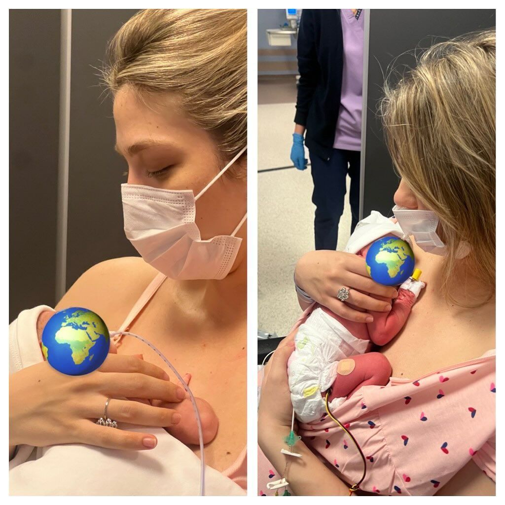 İkizlerinden biri ameliyat olmuştu! Yasemin Şefkatli'den İbrahim Ayel itirafı 2