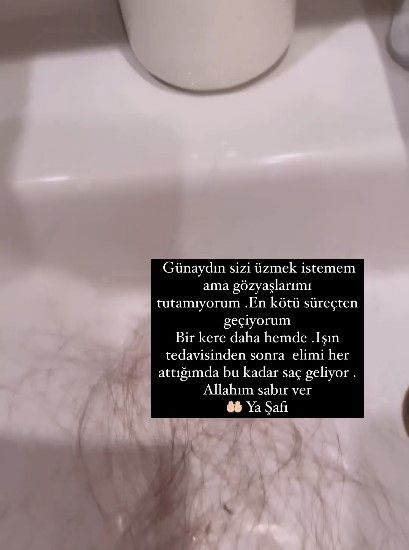 Meme kanserini yenip beyin tümörüne yakalanmıştı! Işın tedavisi gören şarkıcı Şimal dökülen saçlarını paylaştı: Gözyaşlarımı tutamıyorum 11