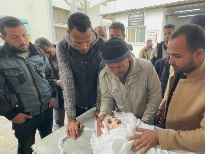 Gazze'de trajedinin fotoğrafı... Filistinli Yezen el-Kefarne yetersiz beslenme nedeniyle hayatını kaybetti 4