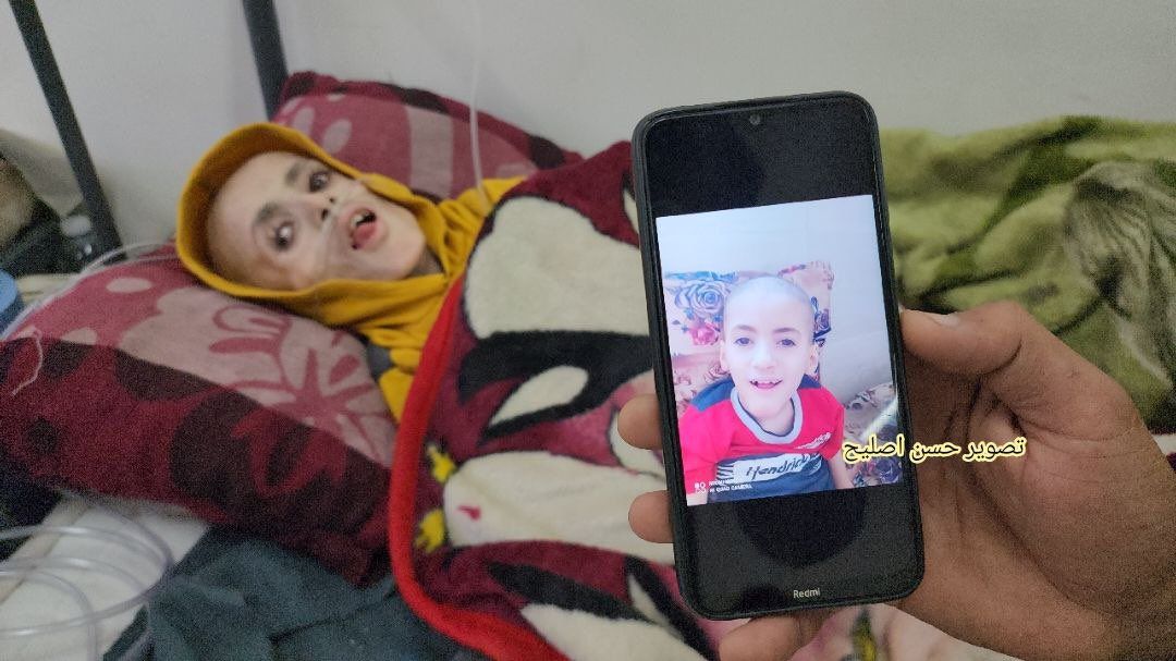 Gazze'de trajedinin fotoğrafı... Filistinli Yezen el-Kefarne yetersiz beslenme nedeniyle hayatını kaybetti 6
