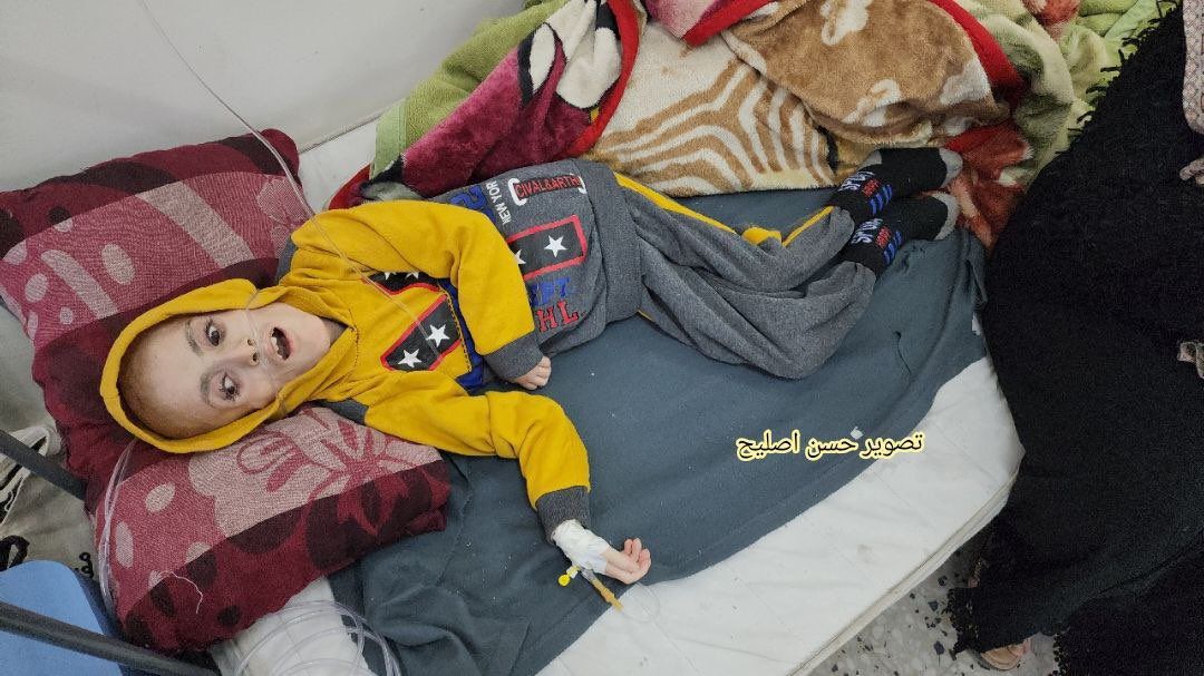 Gazze'de trajedinin fotoğrafı... Filistinli Yezen el-Kefarne yetersiz beslenme nedeniyle hayatını kaybetti 7