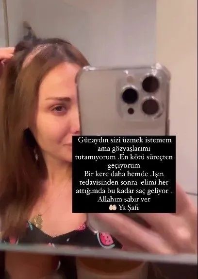 Meme kanserini yenip beyin tümörüne yakalanmıştı! Işın tedavisi gören Şimal son halini paylaştı! 'Dikişlerim kapandı...' 6