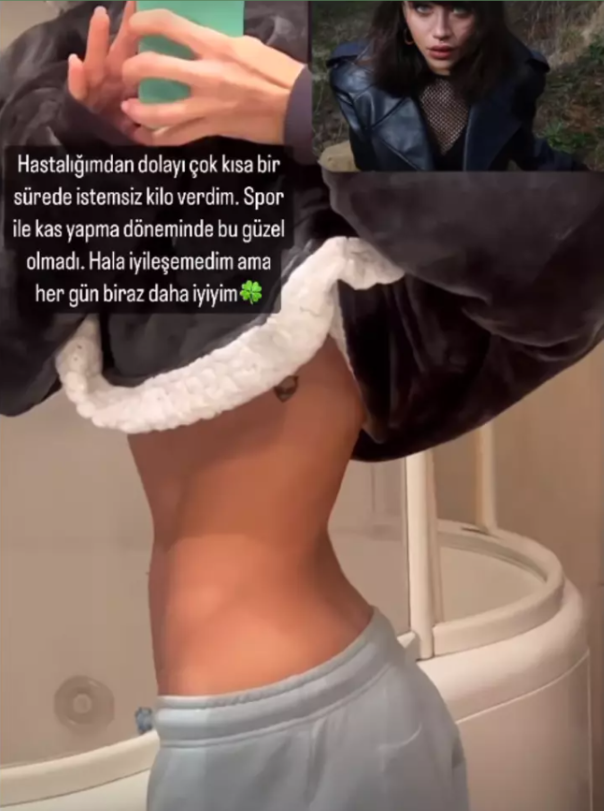 Hamdi Alkan'ın kızı Zeynep Alkan bir deri bir kemik kaldı! İşte nedeni 4