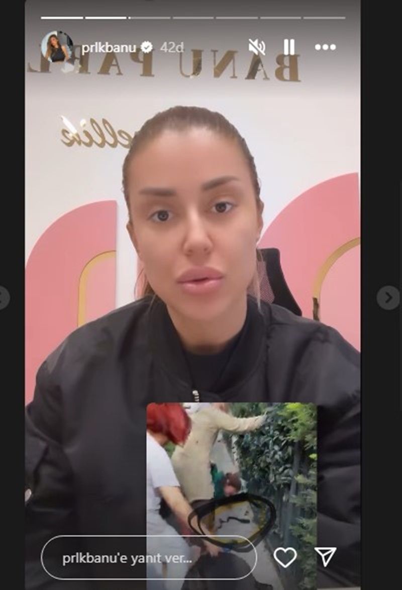 Köpeği dehşet saçan Banu Parlak, ''Beni katil ilan ettiniz'' diyerek isyan etti! ''Beyzbol sopalarıyla bana saldırdılar, darp raporu aldım'' 8