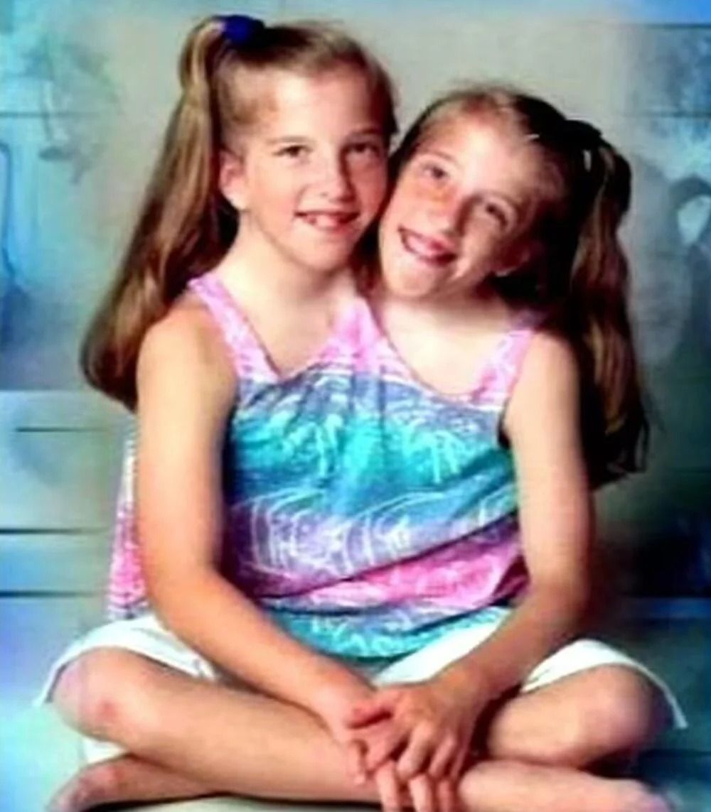 Yapışık ikizler Abby ve Brittany Hensel, ABD'li bir gazi ile dünya evine girdi! 5