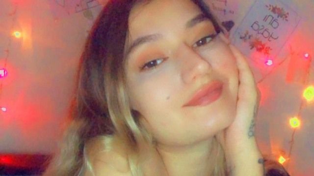 Ameliyatta burun estetiği bozuldu! 1 milyon liralık tazminat davası açtı 1
