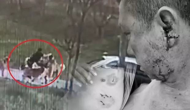 Başıboş köpek sürüsü dehşet saçtı: Baba ölümden döndü, oğlu son anda kurtuldu! 4