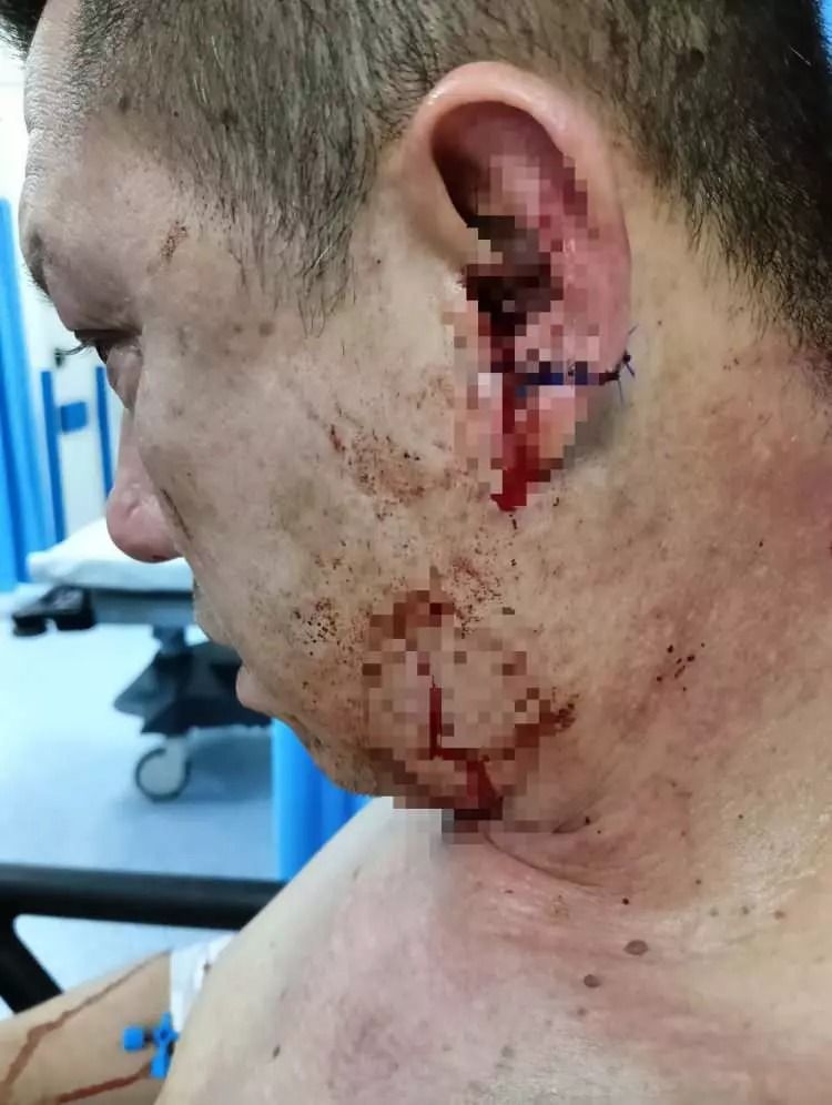 Başıboş köpek sürüsü dehşet saçtı: Baba ölümden döndü, oğlu son anda kurtuldu! 6