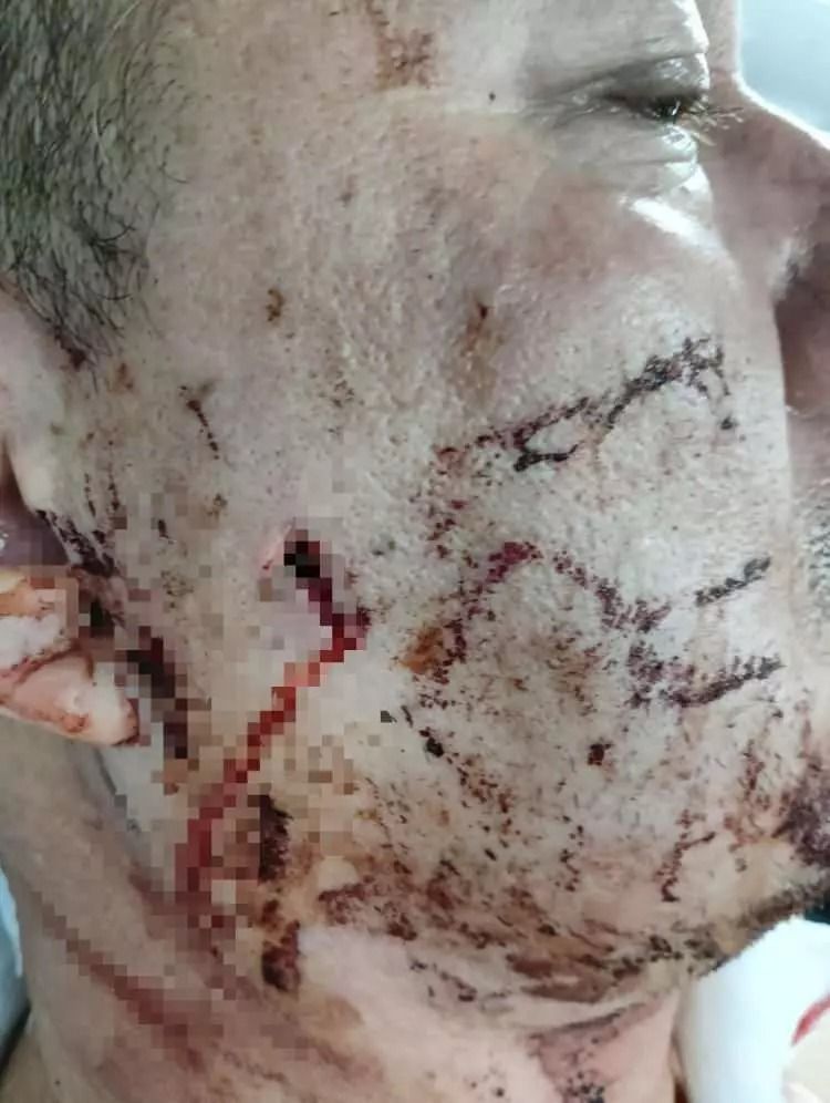 Başıboş köpek sürüsü dehşet saçtı: Baba ölümden döndü, oğlu son anda kurtuldu! 7