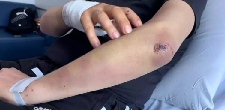 Başıboş köpek sürüsü dehşet saçtı: Baba ölümden döndü, oğlu son anda kurtuldu! 8