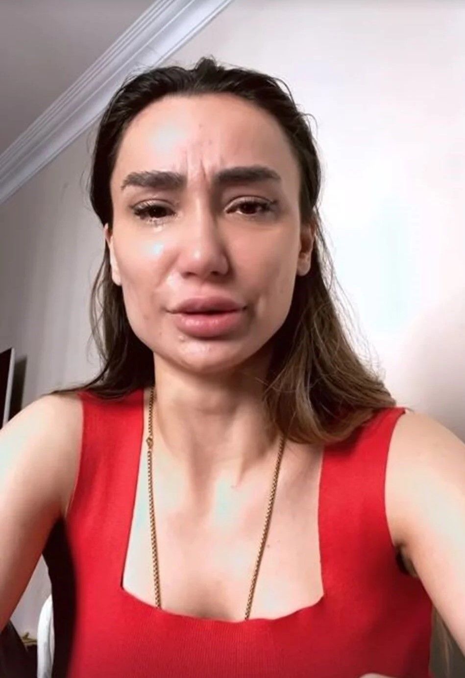 İntihar edeceğini açıklamıştı! Emre Aşık'ın eski eşi Yağmur Sarnıç canına kıymaya kalktı 2