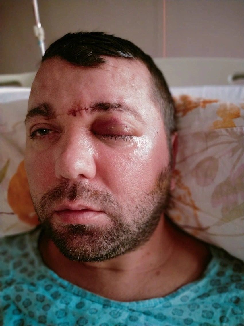 Bursa’da diş ameliyatında vahşet! Beynine vida saplandı 4