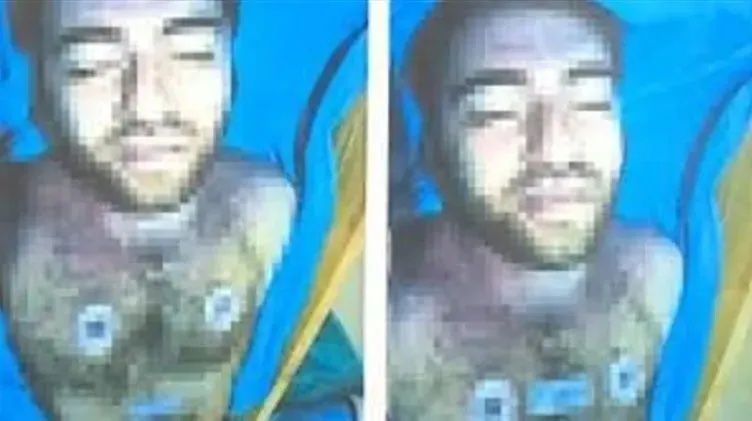 Cem Garipoğlu'nun otopsi fotoğraflarında dikkat çeken detay! Ellerindeki mor lekelerin sırrı çözüldü... 2