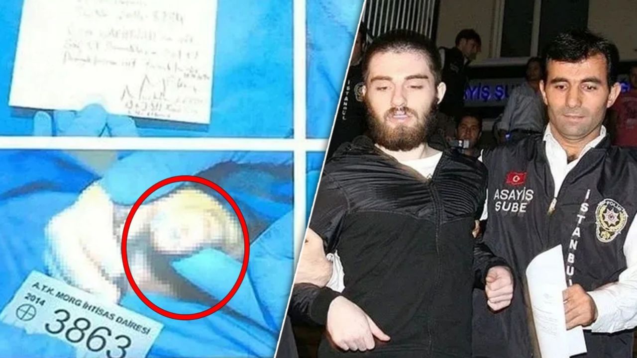 Cem Garipoğlu'nun otopsi fotoğraflarında dikkat çeken detay! Ellerindeki mor lekelerin sırrı çözüldü... 1