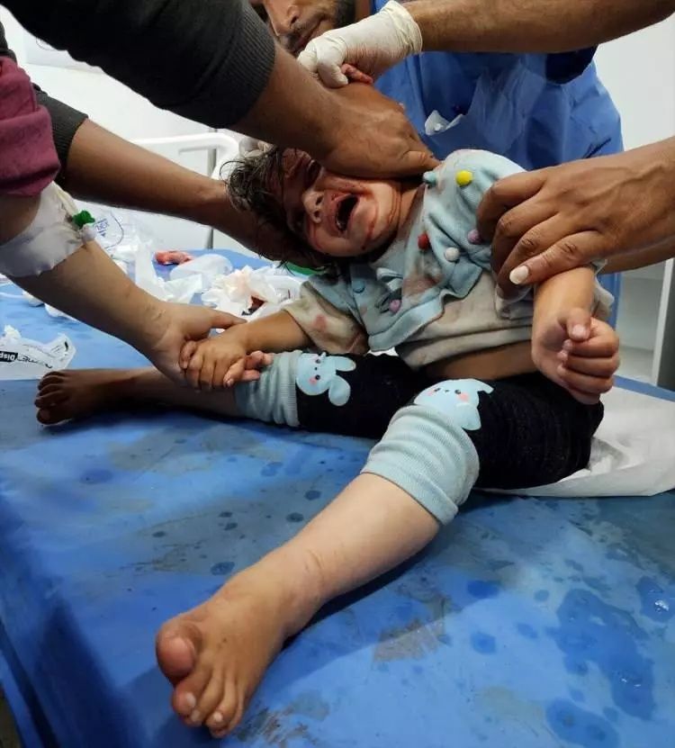 İsrail Refah'ta katliam yaptı! Onlarca Filistinli diri diri yandı! Korkunç görüntüler geliyor... 23