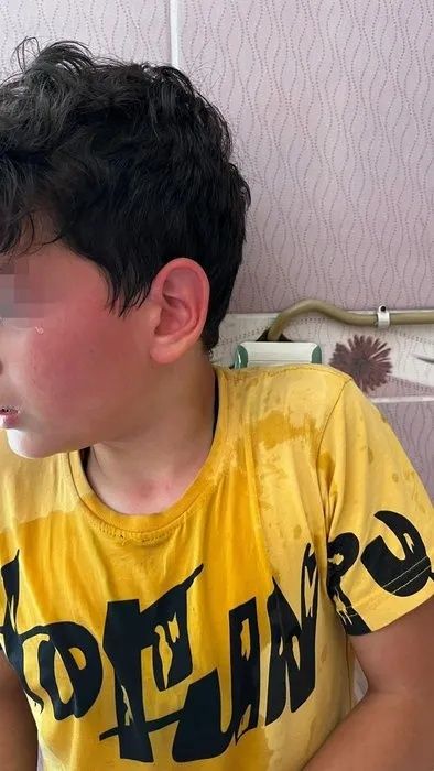 Karaman'da öğretmen dehşeti! Öğrencisini kaynar suyla haşlayıp başını duvara vurdu! 5