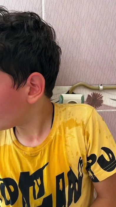 Karaman'da öğretmen dehşeti! Öğrencisini kaynar suyla haşlayıp başını duvara vurdu! 2