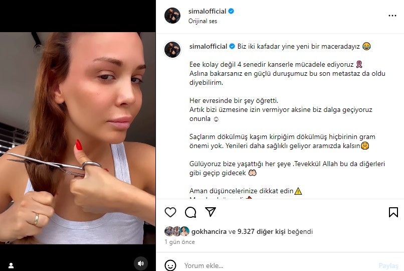 Kanserle mücadele eden Şimal, hastalığı nüksedince saçlarını kazıttı 5