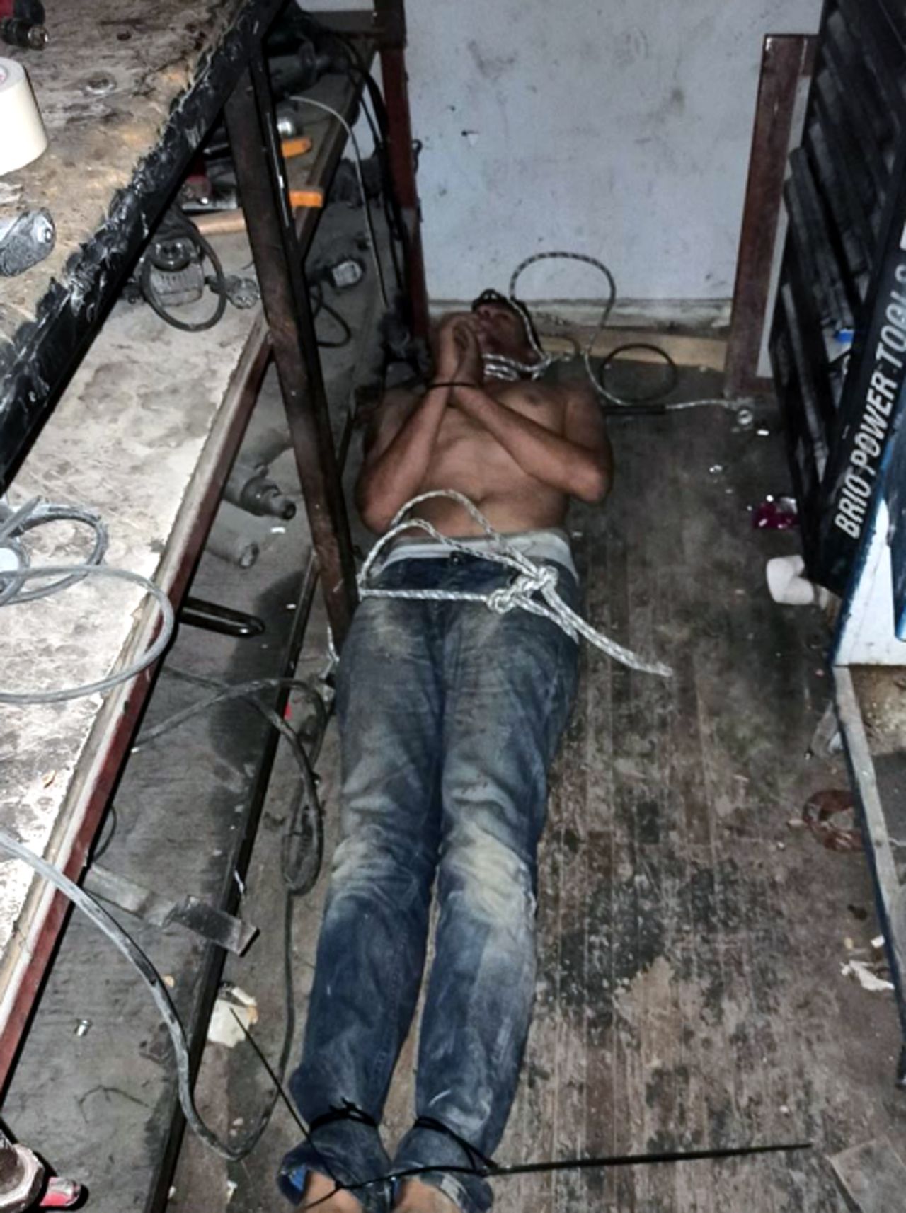 Patron tarafından alıkoyulan işçi 3 gün darbedildi, böcek yedirildi, dişleri kırıldı 1