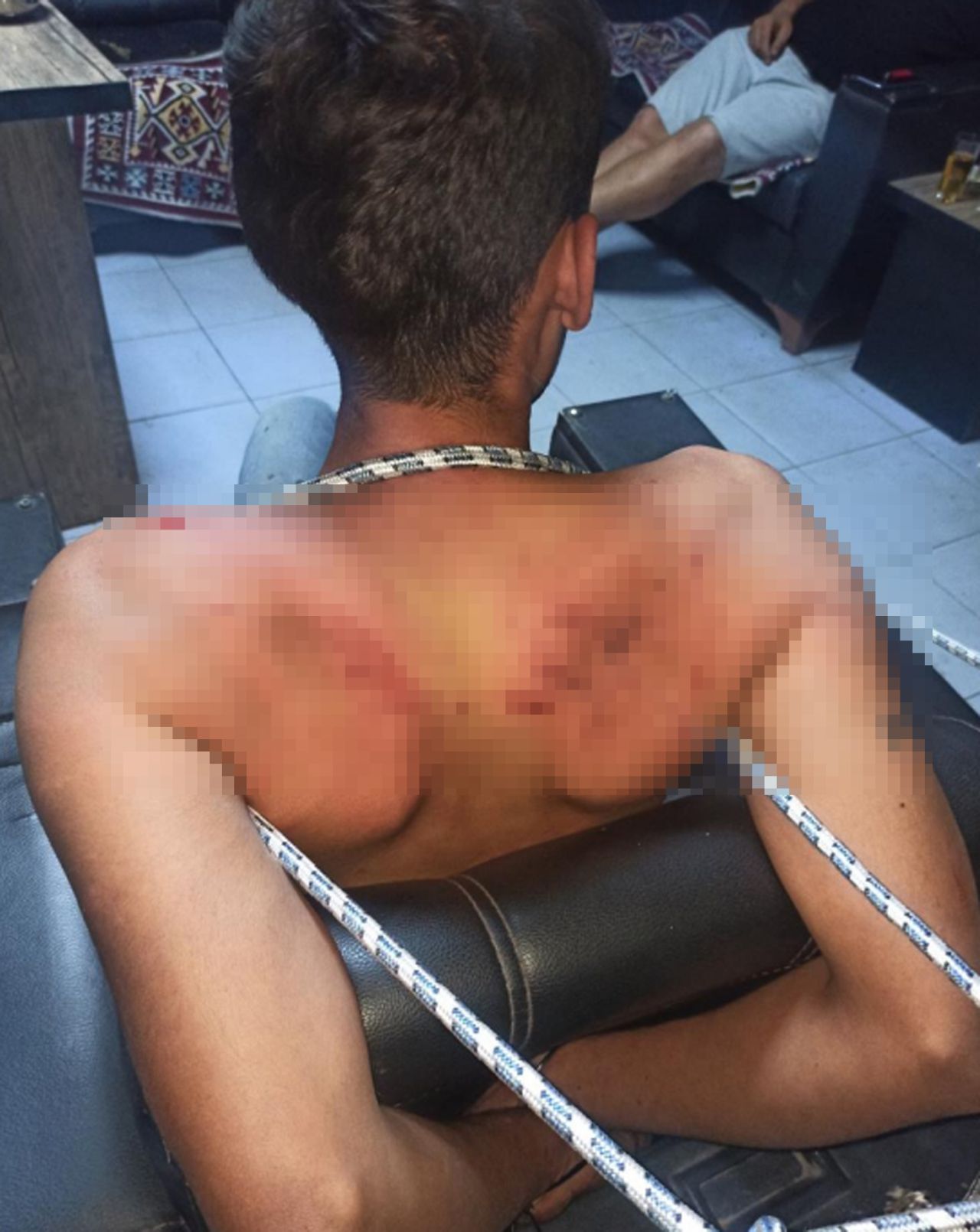 Patron tarafından alıkoyulan işçi 3 gün darbedildi, böcek yedirildi, dişleri kırıldı 4