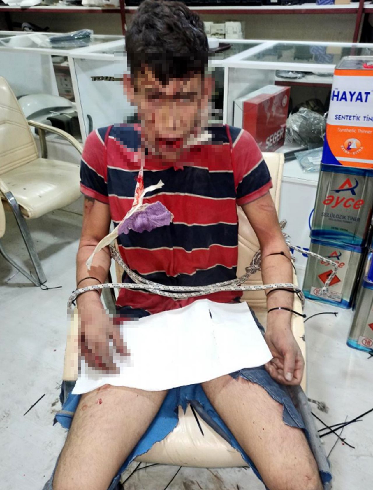 Patron tarafından alıkoyulan işçi 3 gün darbedildi, böcek yedirildi, dişleri kırıldı 5