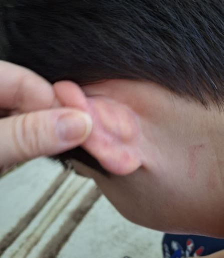 Oğlunun kulağındaki tırnak izi, morluk ve kolundaki çizik o anneyi harekete geçirdi! Özel eğitim okulunda 'otizmli öğrenciyi darp' soruşturması: Öğretmenler suçlanıyor 5