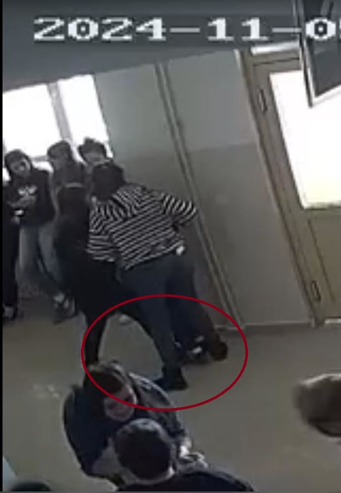 Oğlunun kulağındaki tırnak izi, morluk ve kolundaki çizik o anneyi harekete geçirdi! Özel eğitim okulunda 'otizmli öğrenciyi darp' soruşturması: Öğretmenler suçlanıyor 6